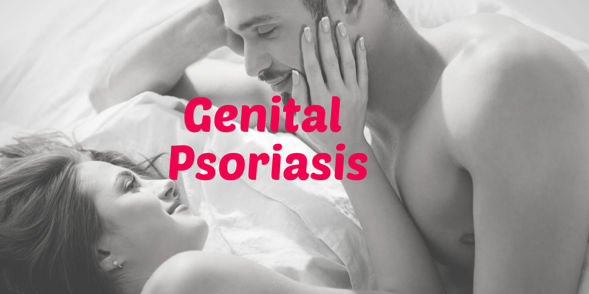 Genital Psoriasis