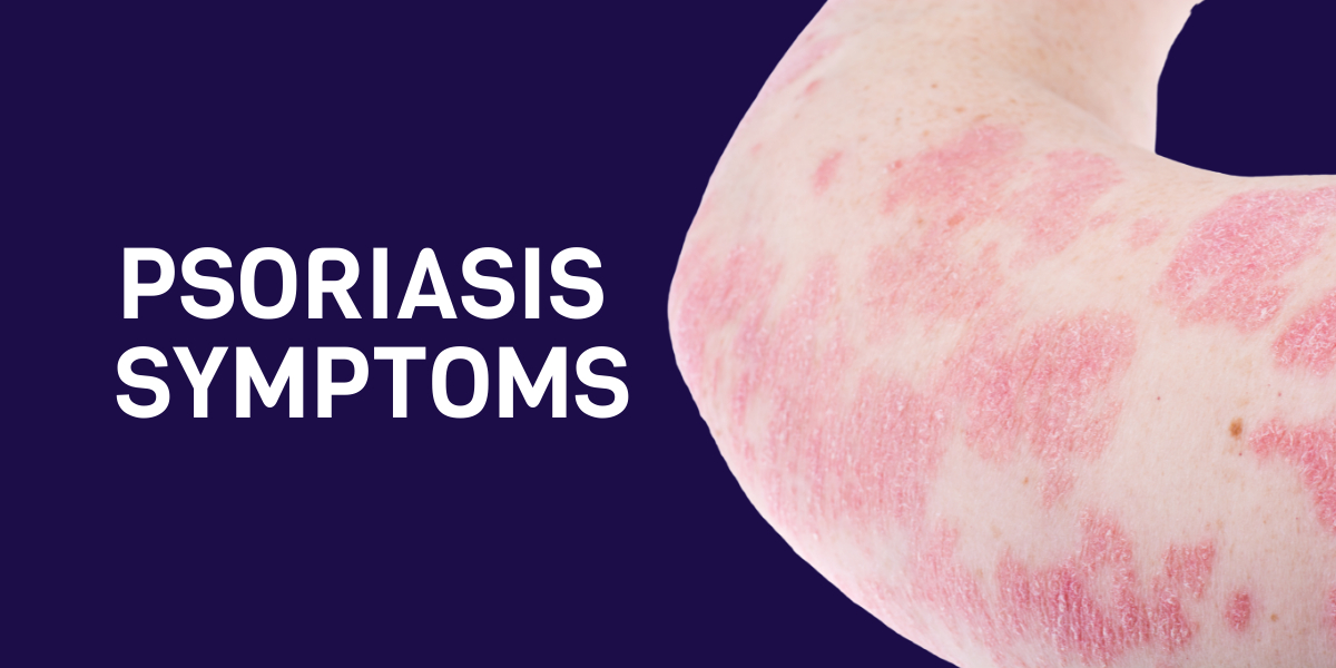What are the symptoms of Psoriasis? - Complete Guide & Tips