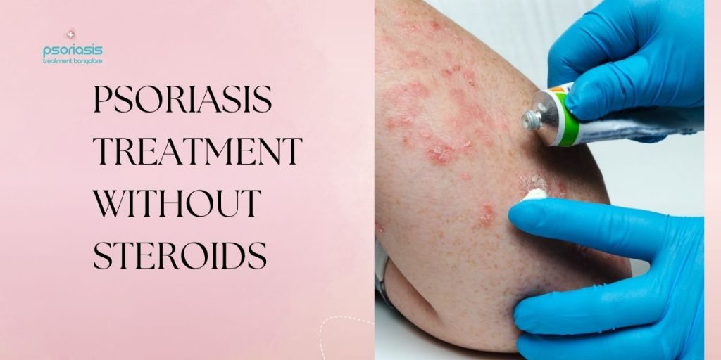 Psoriasis Treatment Without Steroids