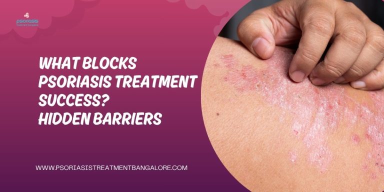 psoriasis treatment barriers