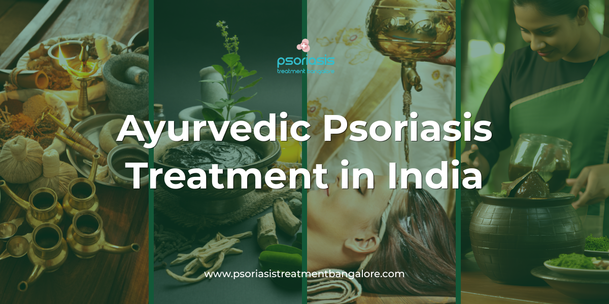 Ayurvedic Psoriasis Treatment in India
