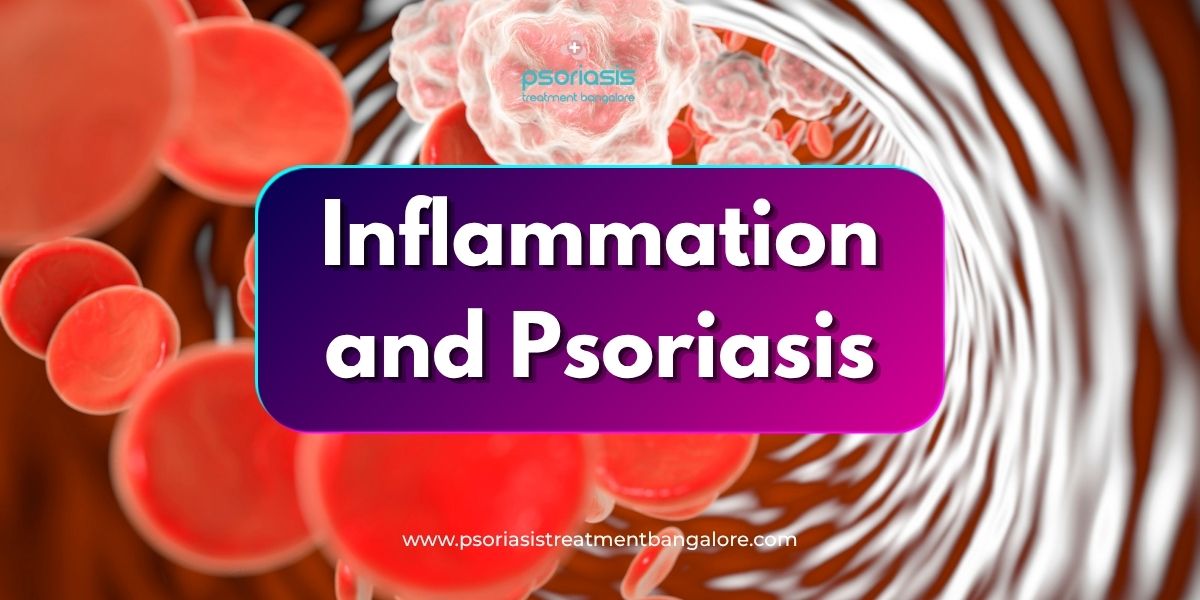 Inflammation and Psoriasis