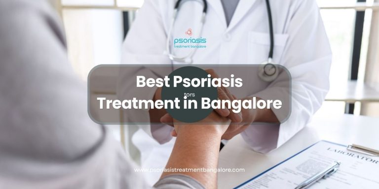 Best Psoriasis Treatment in Bangalore