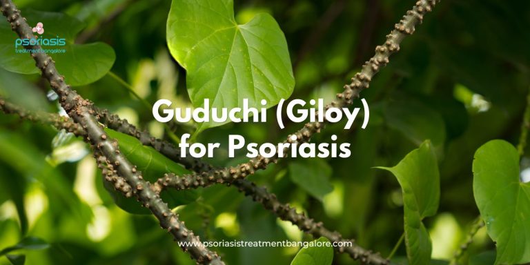 Guduchi (Giloy) for Psoriasis