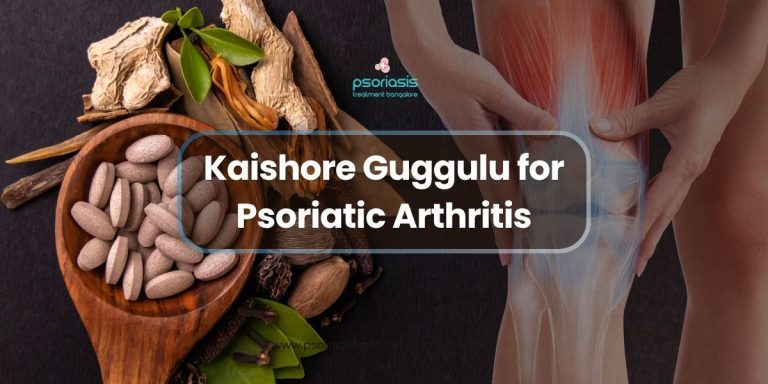 Kaishore Guggulu for Psoriatic Arthritis