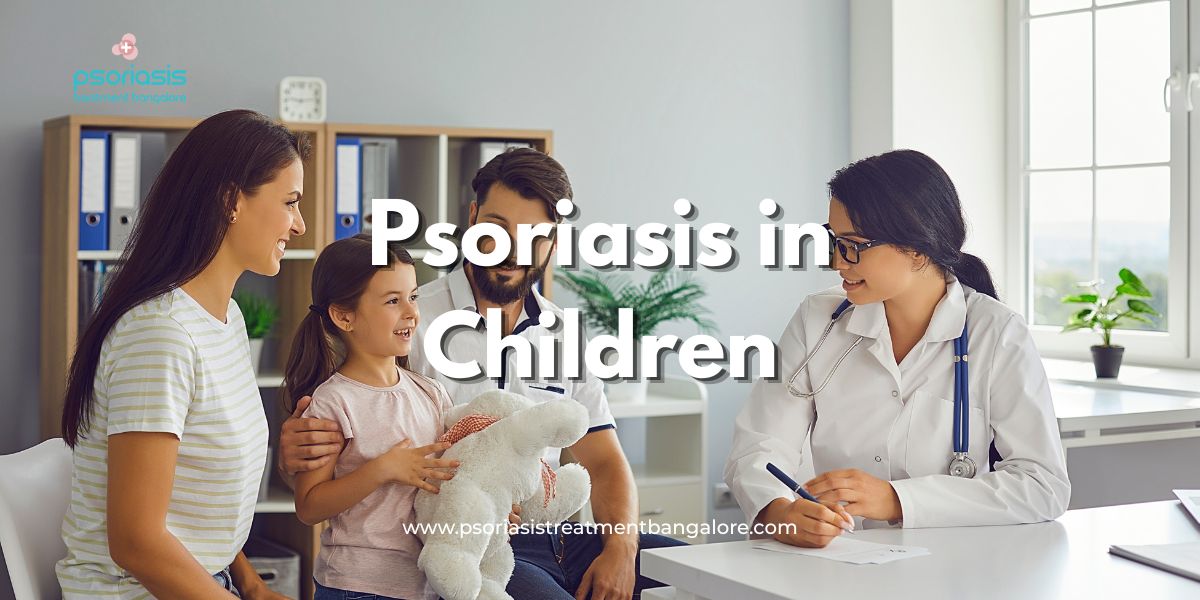Psoriasis in Children