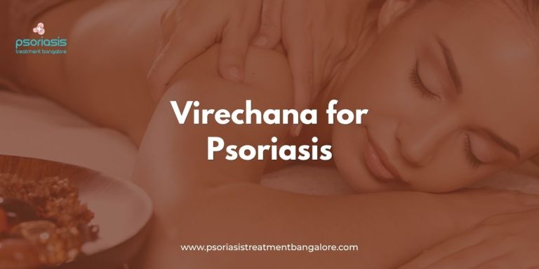 Virechana for Psoriasis