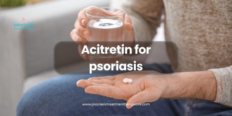 Acitretin for psoriasis