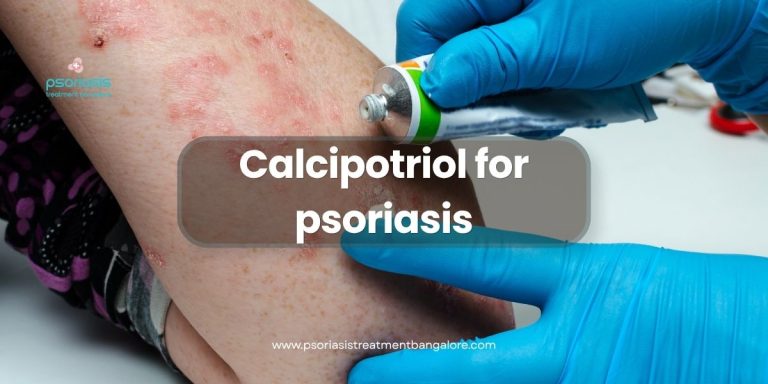 Calcipotriol for psoriasis