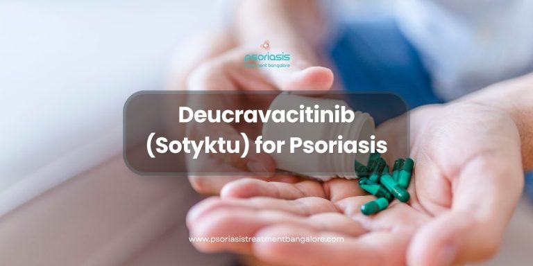 Deucravacitinib (Sotyktu) for Psoriasis