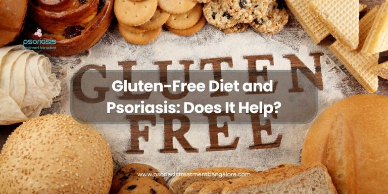 Gluten-Free Diet and Psoriasis: Does It Help