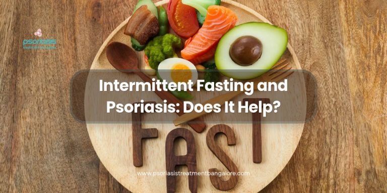 Intermittent Fasting and Psoriasis: Does It Help?