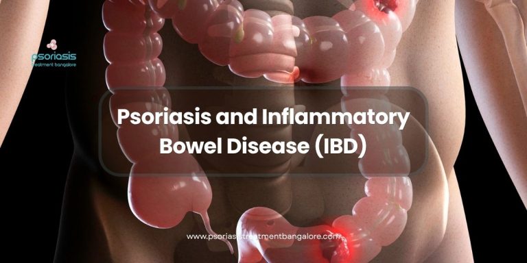 Psoriasis and Inflammatory Bowel Disease (IBD)