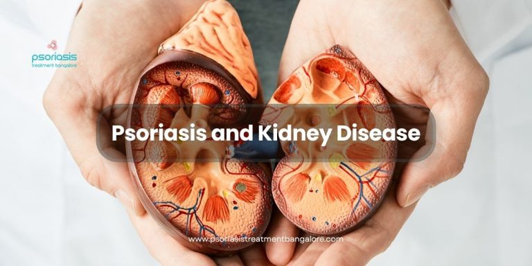 Psoriasis and Kidney Disease